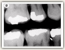 Example of digital radiology for dental patient x-rays